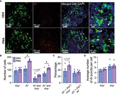 Prenatal androgen treatment impairs the suprachiasmatic nucleus arginine-vasopressin to kisspeptin neuron circuit in female mice